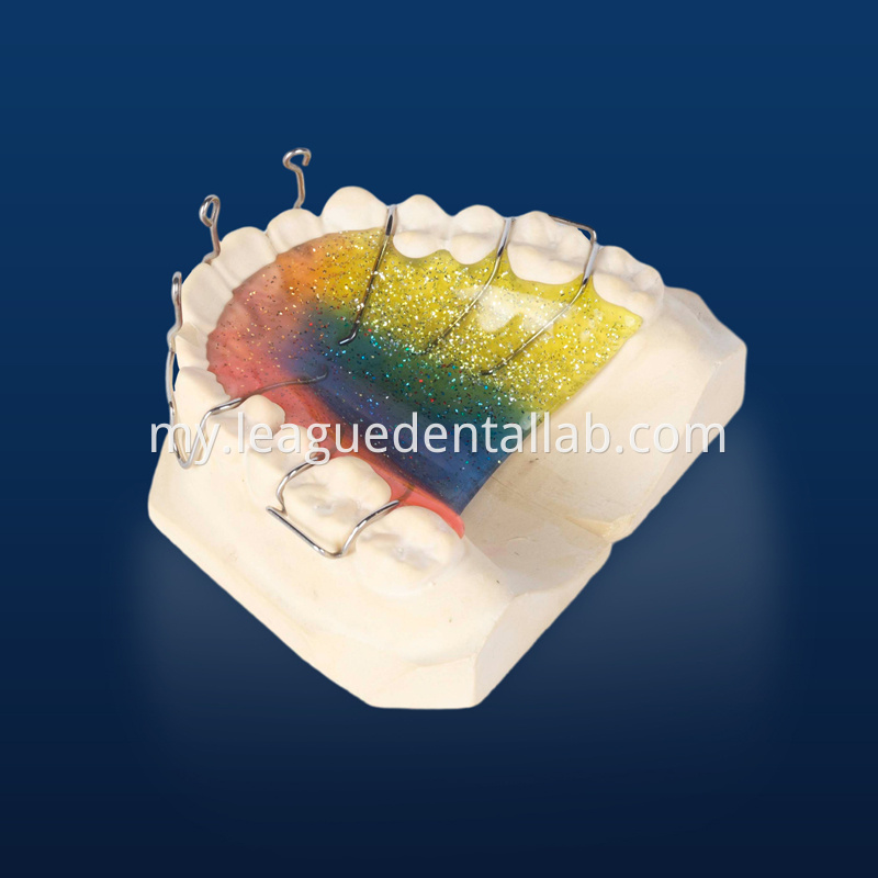 Cast partial,3D printed metal partial,Bego metal partial,cast metal framework,Vatalium Metal framework